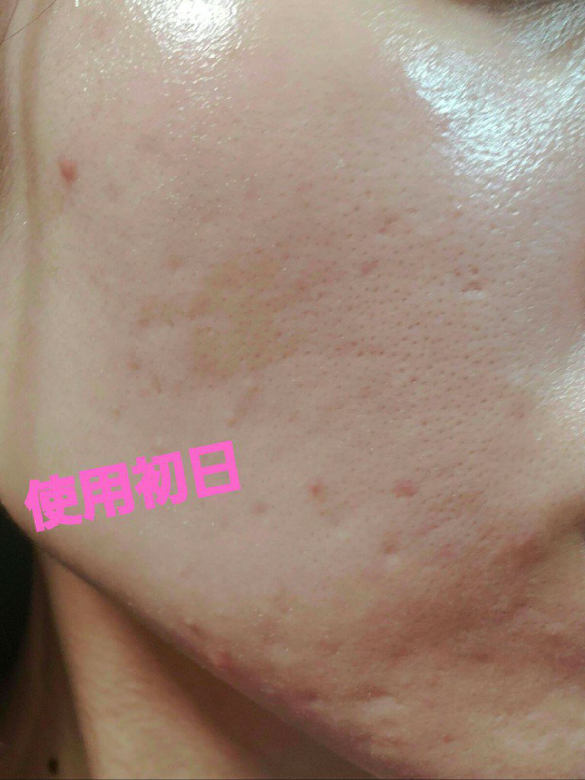 C25セラム ネオ/オバジ/美容液を使ったクチコミ（2枚目）