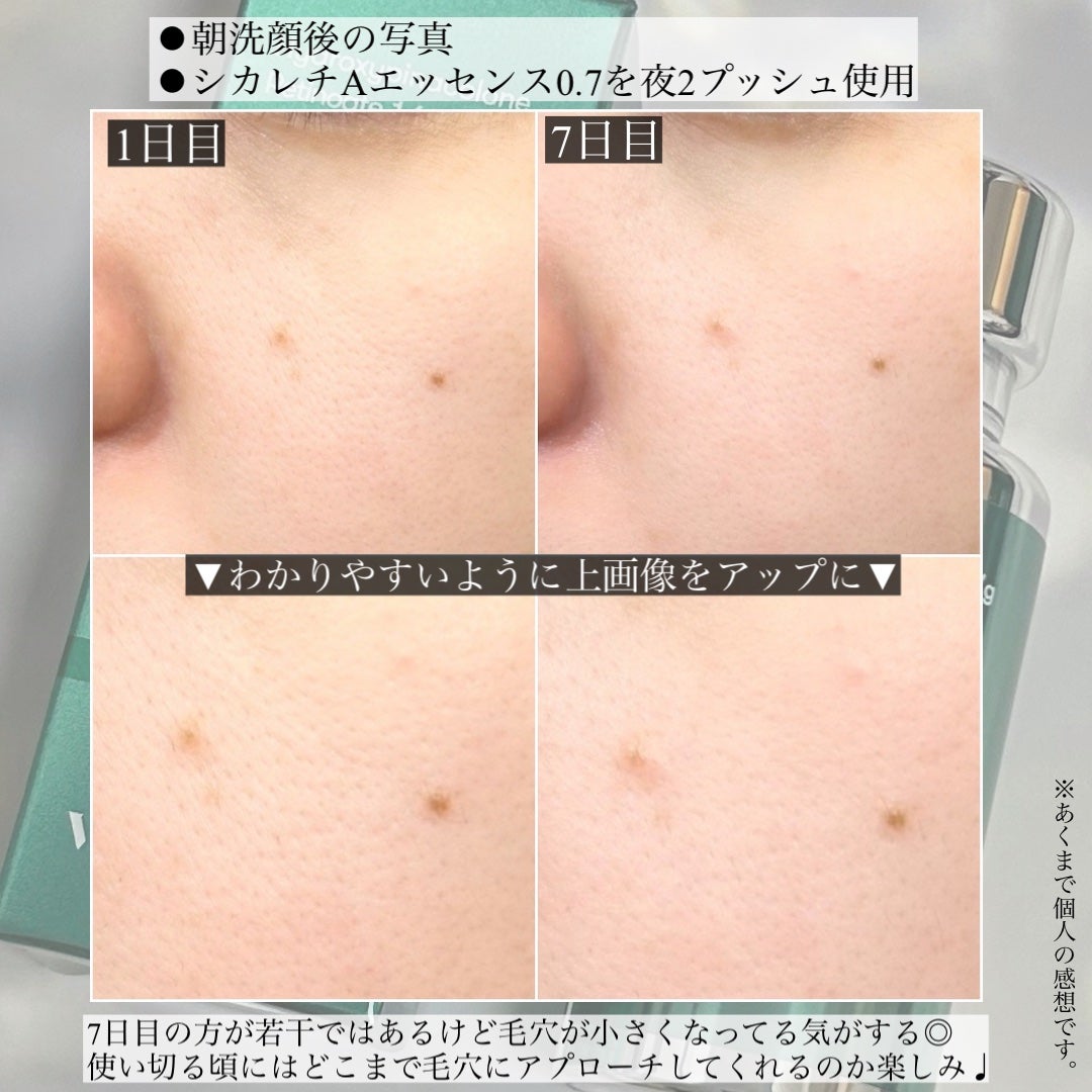 シカレチA エッセンス0.7/VT/美容液を使ったクチコミ(4枚目)
