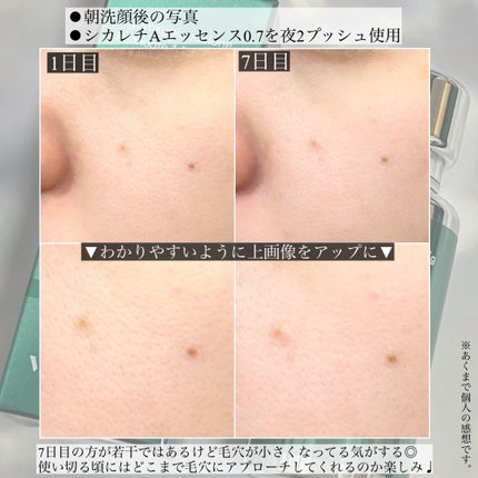 シカレチA エッセンス0.7/VT/美容液を使ったクチコミ(4枚目)