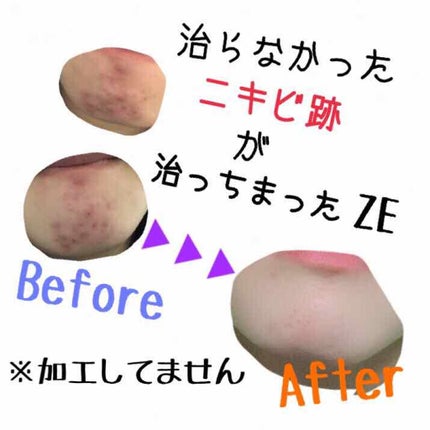 敏感肌用薬用美白美容液/無印良品/美容液を使ったクチコミ(1枚目)