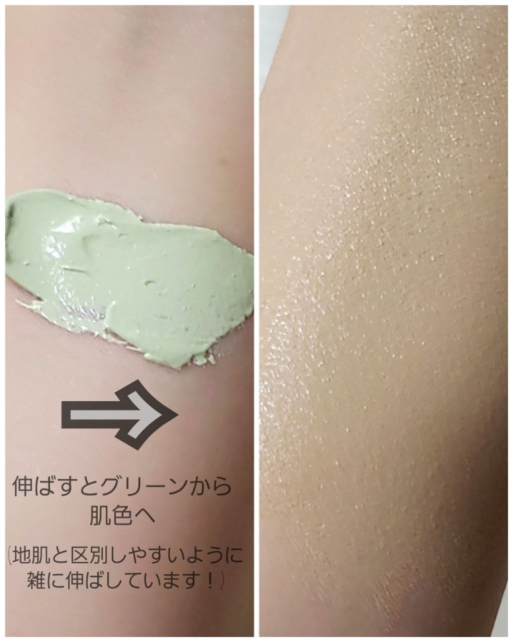 ドクタージャルト シカペア リカバー (第2世代)/Dr.Jart+/フェイスクリームを使ったクチコミ(3枚目)