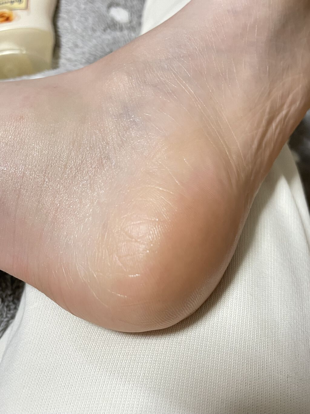 ゴウンバル クリーム/3WB/レッグ・フットケアを使ったクチコミ（3枚目）