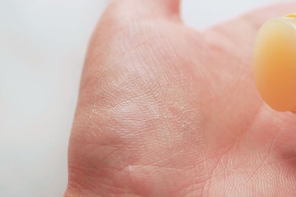 ゆずナイアシンダークスポットコレックティングスティック/SOME BY MI/美容液を使ったクチコミ(4枚目)