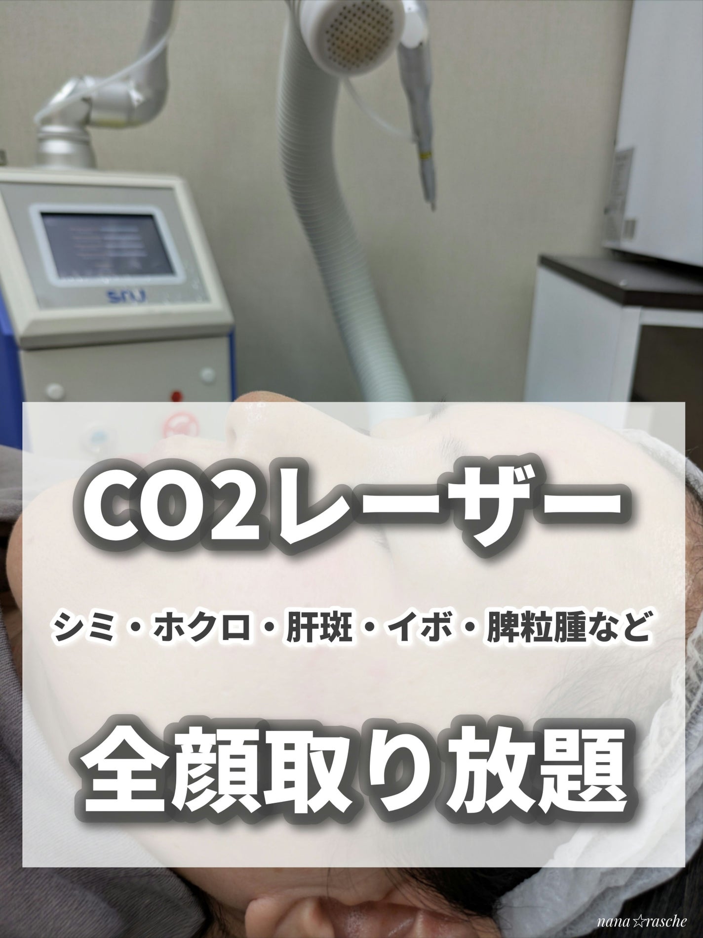 nana☆rasche on LIPS 「今回、韓国旅行のついでに明洞にあるクリニックでCO2レーザー治..」(1枚目)