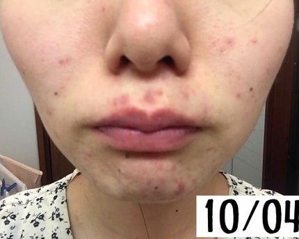 ドクタージャルト シカペア クリーム (第2世代)/Dr.Jart+/フェイスクリームを使ったクチコミ(2枚目)