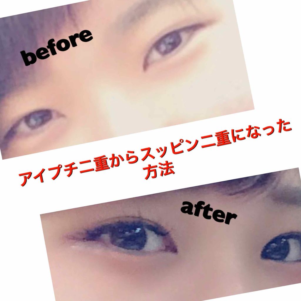 シングルアイテープ/Automatic Beauty/二重まぶた用アイテムを使ったクチコミ(1枚目)