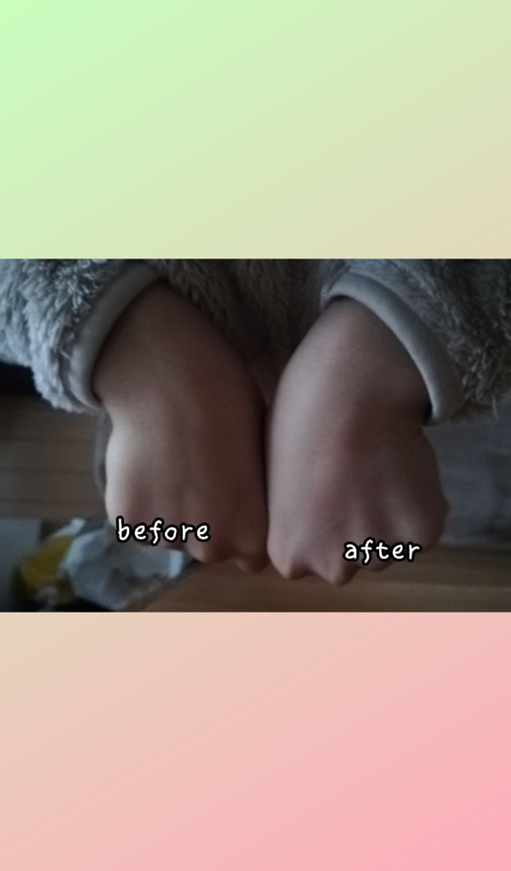 ハトムギ化粧水(ナチュリエ スキンコンディショナー R )/ナチュリエ/化粧水を使ったクチコミ（2枚目）