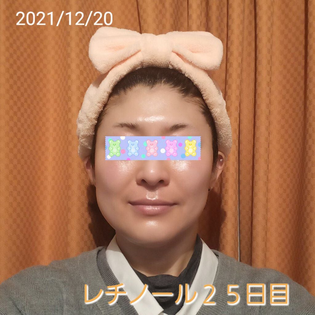 トレチノインジェル/A-Ret/美容液を使ったクチコミ(1枚目)