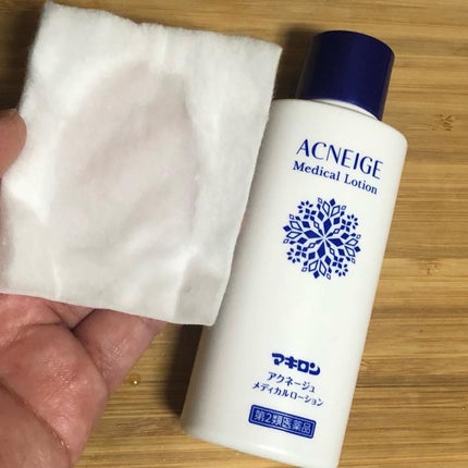 マキロン アクネージュ メディカルローション (医薬品)/マキロン/その他を使ったクチコミ(6枚目)