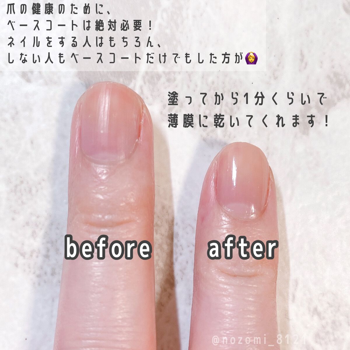 ザ ベースコート/ADDICTION/ネイルトップコートを使ったクチコミ（2枚目）