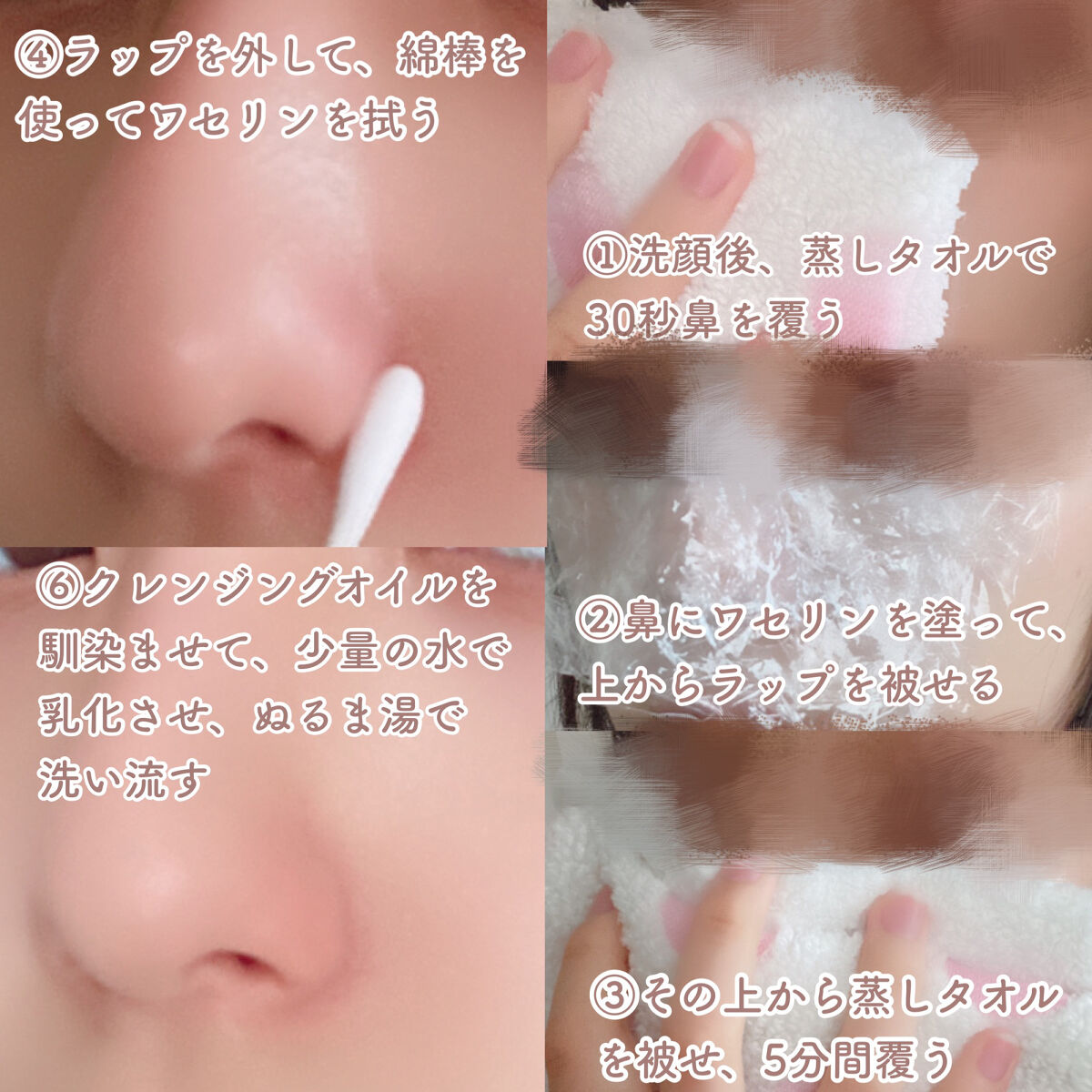 オリジナル ピュアスキンジェリー/ヴァセリン/ボディクリームを使ったクチコミ（3枚目）