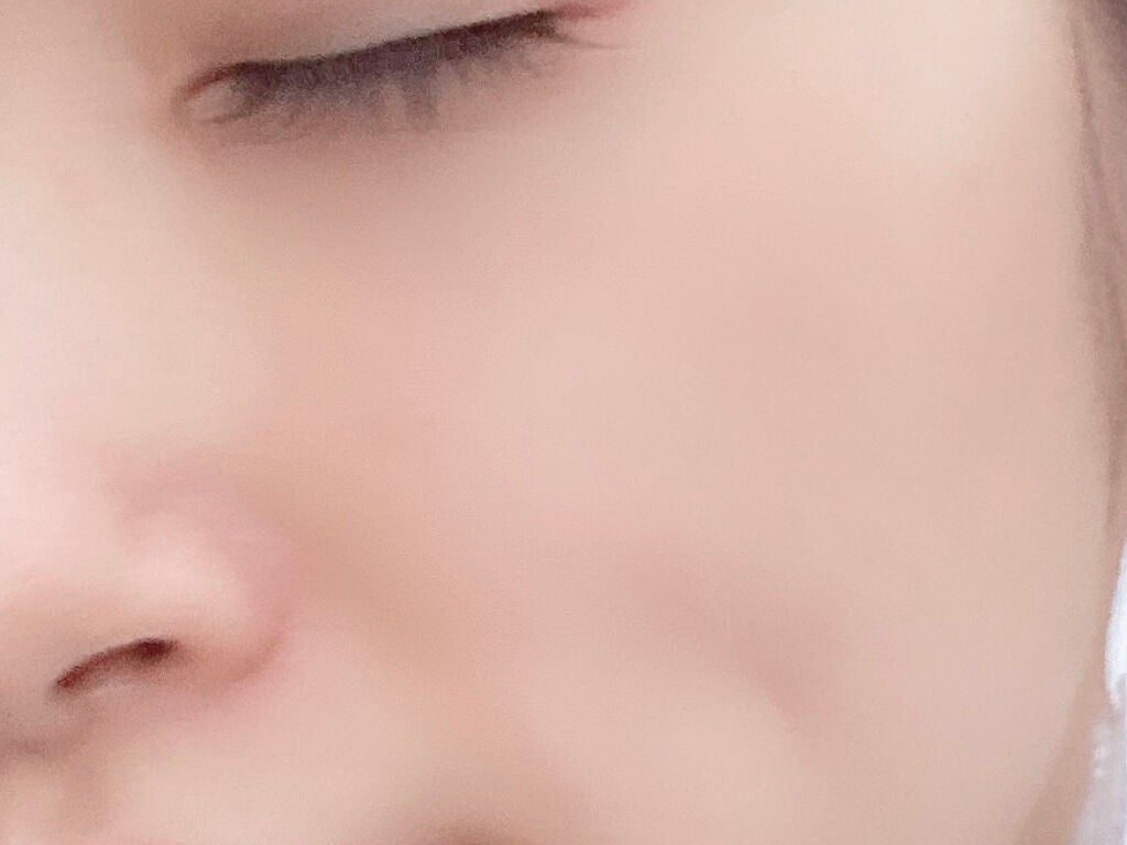 エムロゼスペシャルボックス/EMROSÉ/スキンケアキットを使ったクチコミ(5枚目)