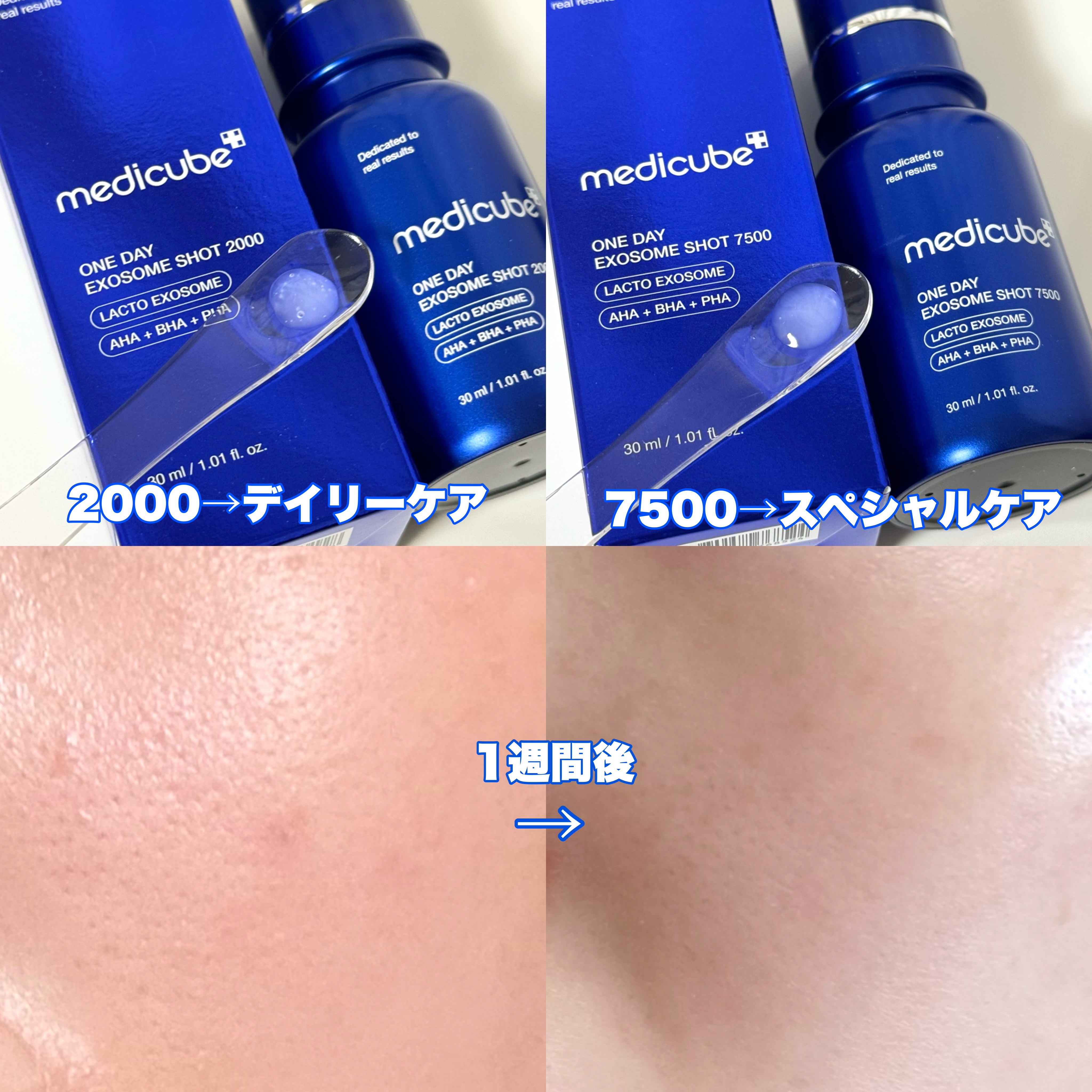 ゼロ1DAYエクソソームショット7500/MEDICUBE/美容液を使ったクチコミ（2枚目）