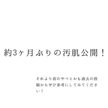 ハトムギ化粧水(ナチュリエ スキンコンディショナー R )/ナチュリエ/化粧水を使ったクチコミ（1枚目）