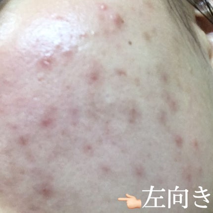 ハトムギ化粧水(ナチュリエ スキンコンディショナー R )/ナチュリエ/化粧水を使ったクチコミ(4枚目)