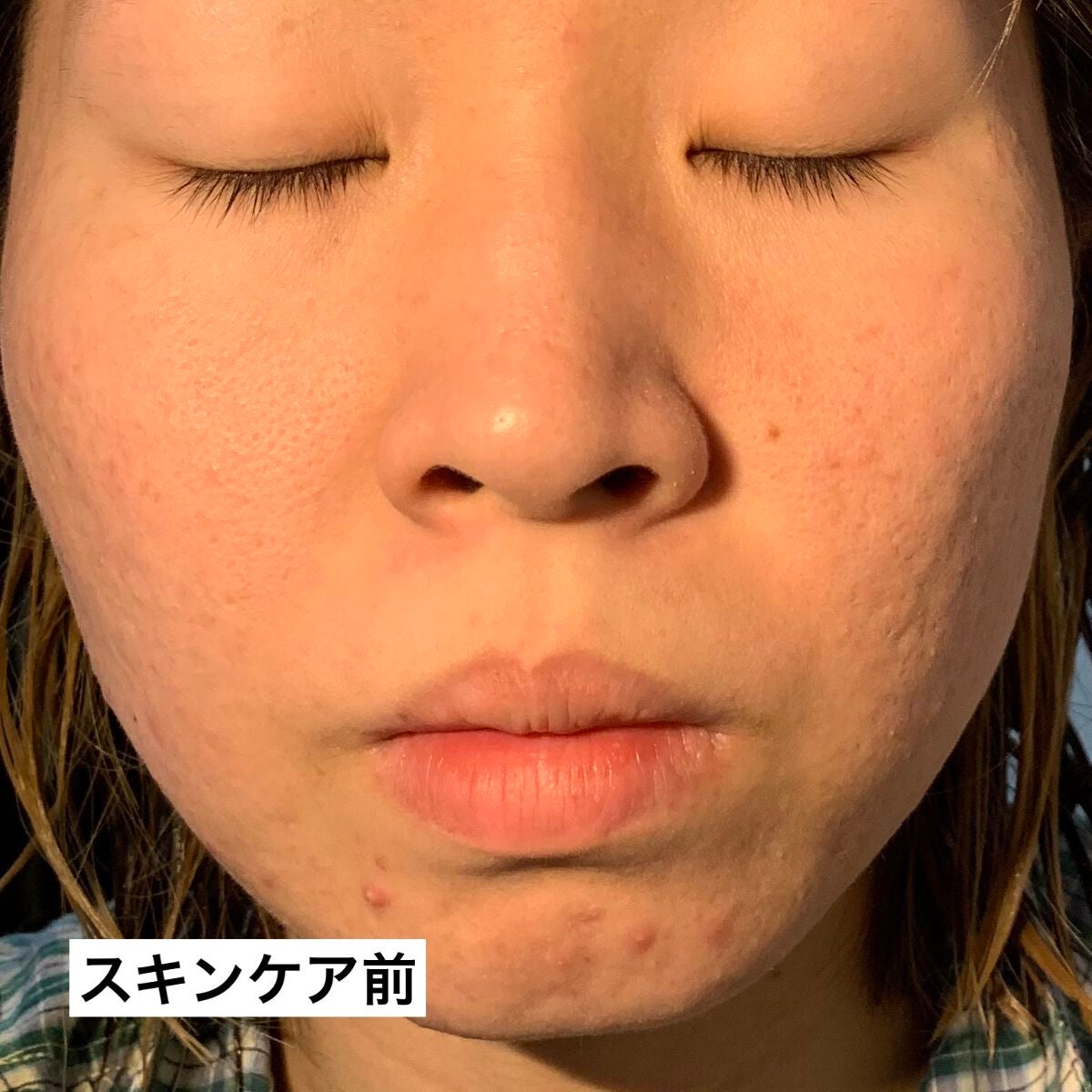 ザ セラム ブライトニング/アスタリフト/美容液を使ったクチコミ(7枚目)