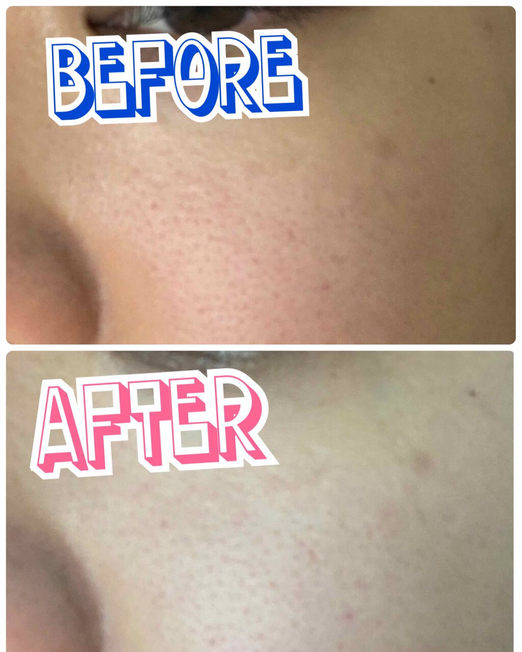 スーパーベジトックスクレンザー/WONDER BATH/クレンジングジェルを使ったクチコミ（2枚目）