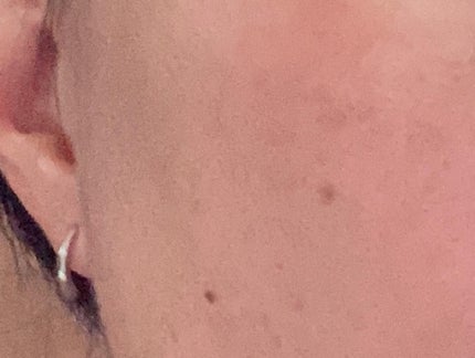 るいめい on LIPS 「.🍀薬用角層ケア美容液(医薬部外品)HAKUリファイナー美白*..」(4枚目)