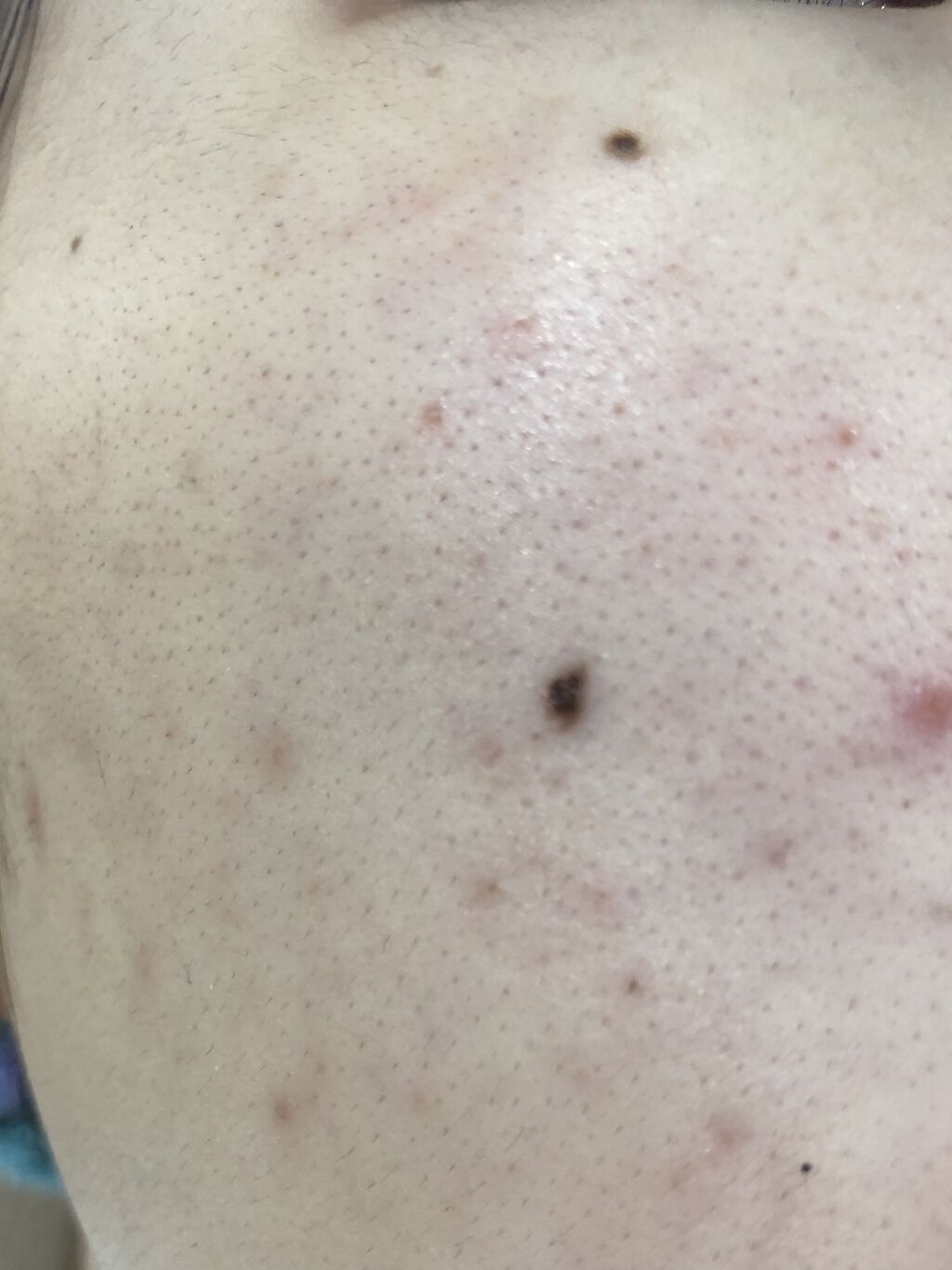 白色ワセリン(医薬品)/健栄製薬/その他を使ったクチコミ（1枚目）