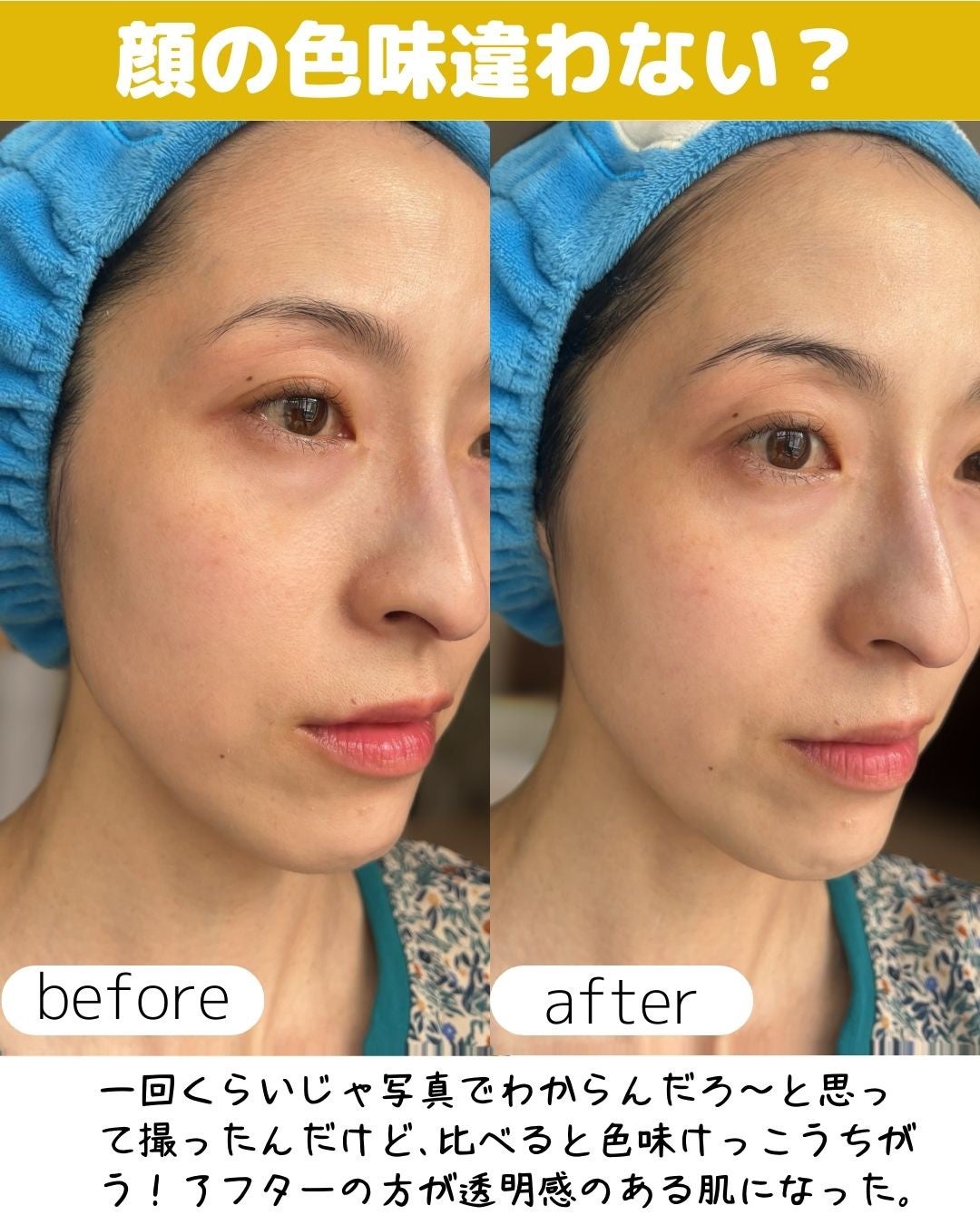 HiCA 炭酸ミルク泡パックC 18000/HiCA/洗い流すパック・マスクを使ったクチコミ(7枚目)