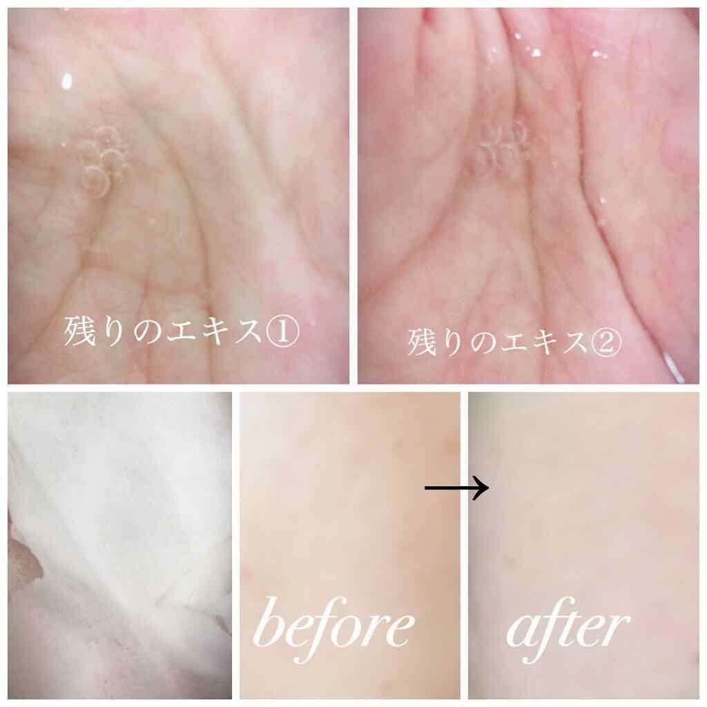 0.2エアフィットマスク/ETUDE/シートマスク・パックを使ったクチコミ（3枚目）