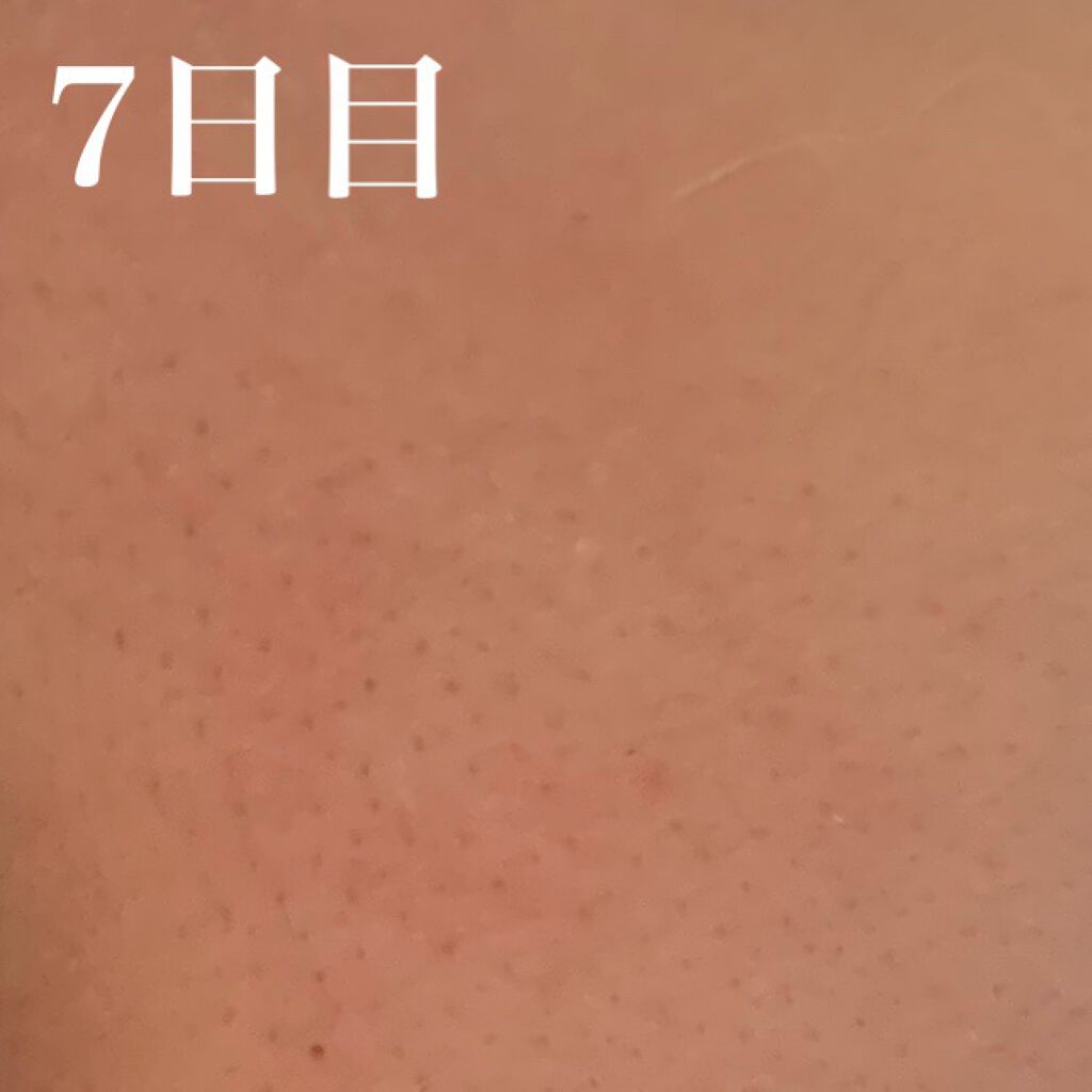 ホワイトニングクリア セット/d プログラム/スキンケアキットを使ったクチコミ(6枚目)