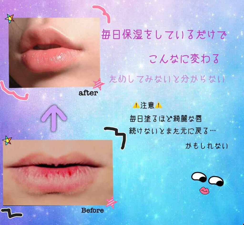 ニベアリップケア 薬用UV/ニベア/リップケアを使ったクチコミ（1枚目）