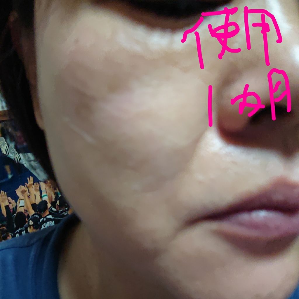 EUKROMA Plus/EUKROMA/その他スキンケアを使ったクチコミ（3枚目）