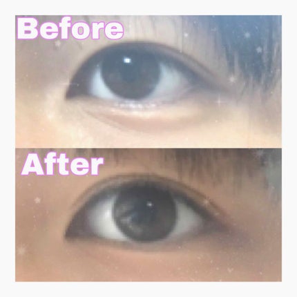 ハイブリッドフィルム/アイトーク/二重まぶた用アイテムを使ったクチコミ(3枚目)