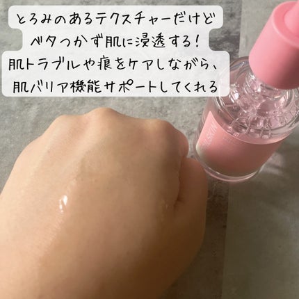 ピンクアロエムチンセラム/APRILSKIN/美容液を使ったクチコミ(3枚目)