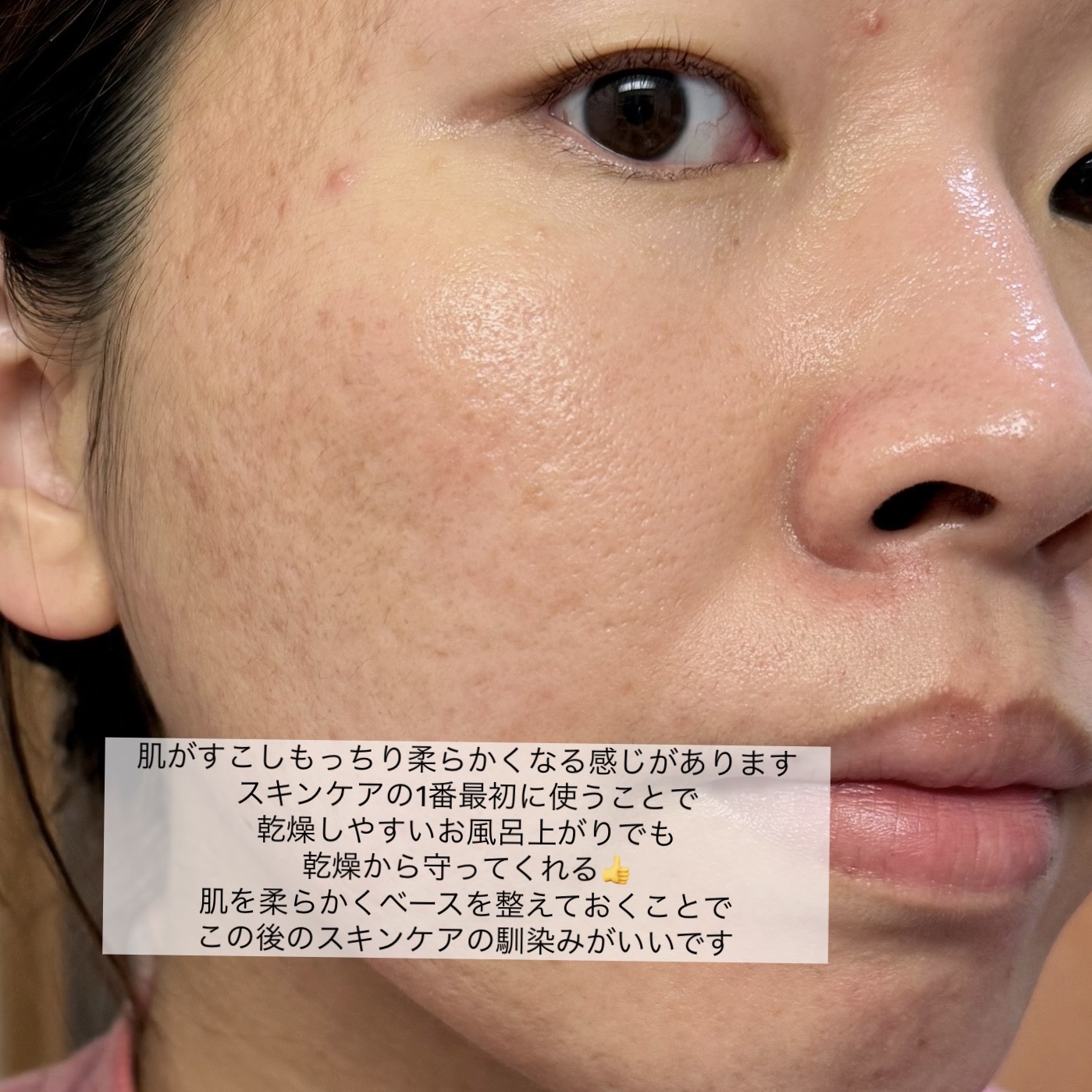 リポソーム アドバンスト　リペアセラム/DECORTÉ/美容液を使ったクチコミ（3枚目）