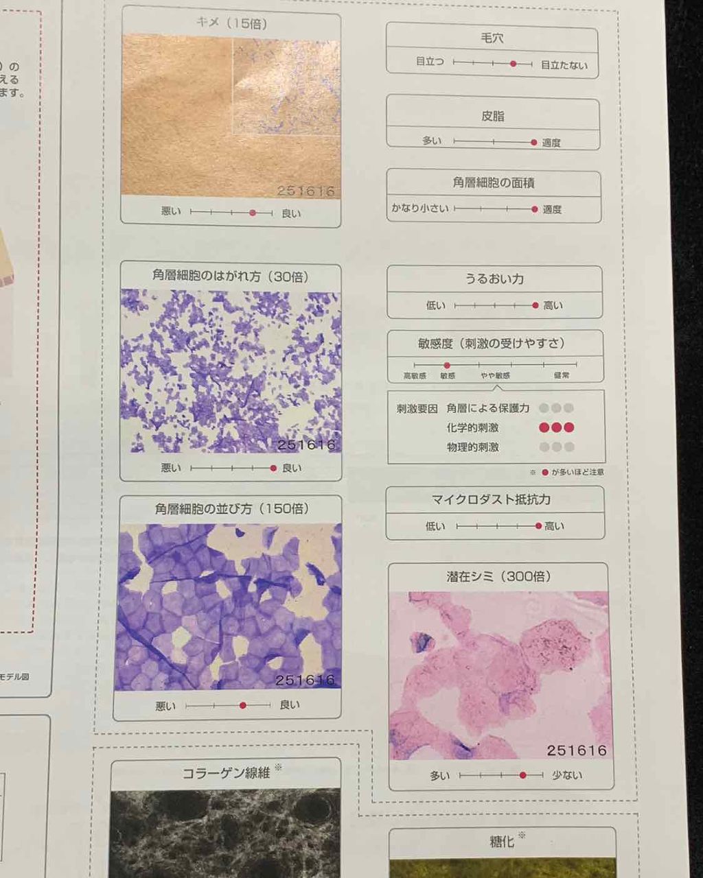 マンスリースキンケアプログラム(旧)/APEX/スキンケアキットを使ったクチコミ(3枚目)