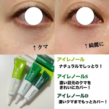 アイレノール クマクリーム/IRENOL/アイケア・アイクリームを使ったクチコミ(3枚目)