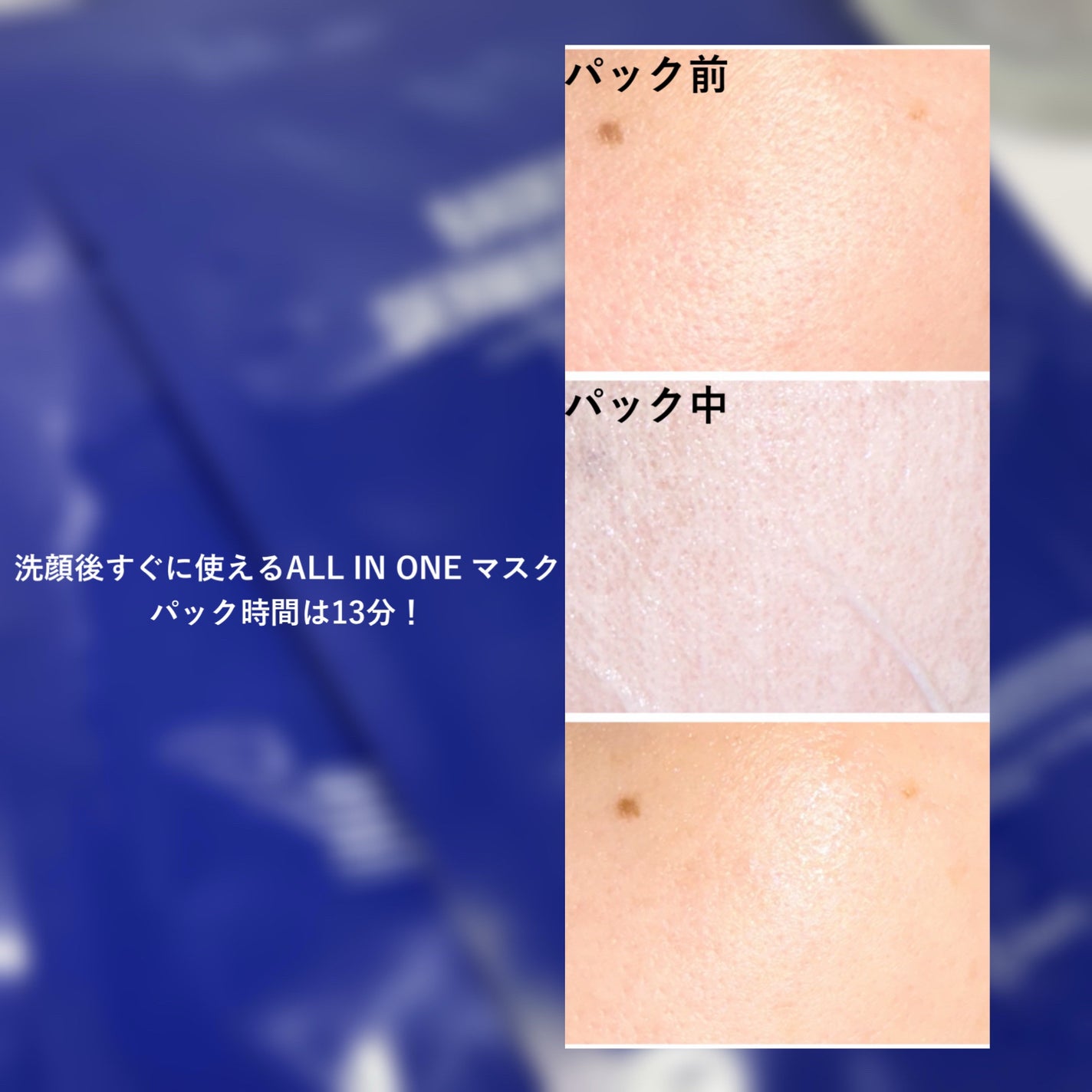 BADECASIL DERMASEAL MASK/23years old/シートマスク・パックを使ったクチコミ(6枚目)