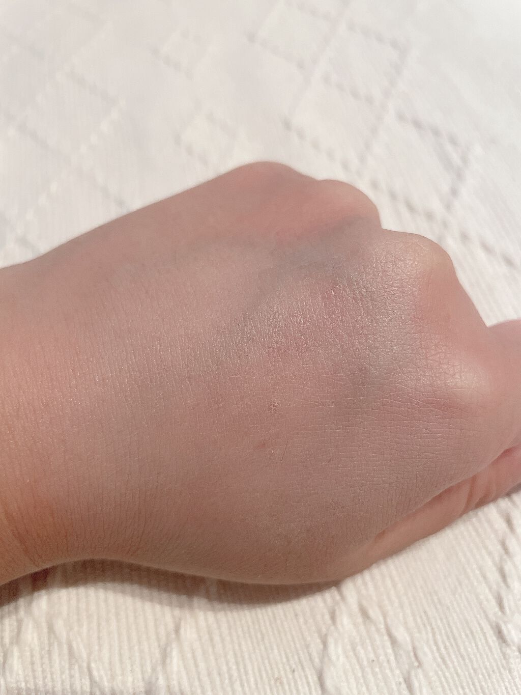 ドクタージャルト シカペア リカバー (第2世代)/Dr.Jart+/フェイスクリームを使ったクチコミ(3枚目)