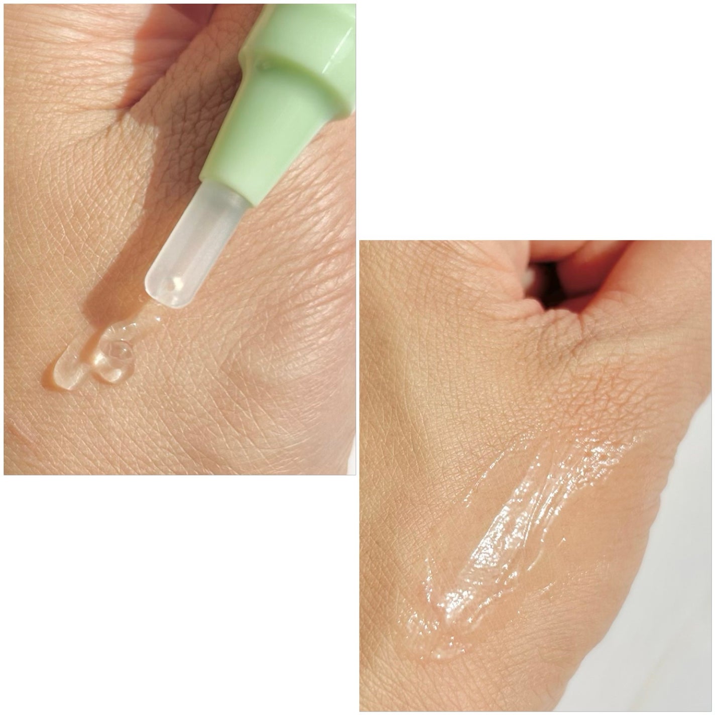 ミラクルクリアスージングスポットジェル/Rael/にきびパッチを使ったクチコミ(3枚目)