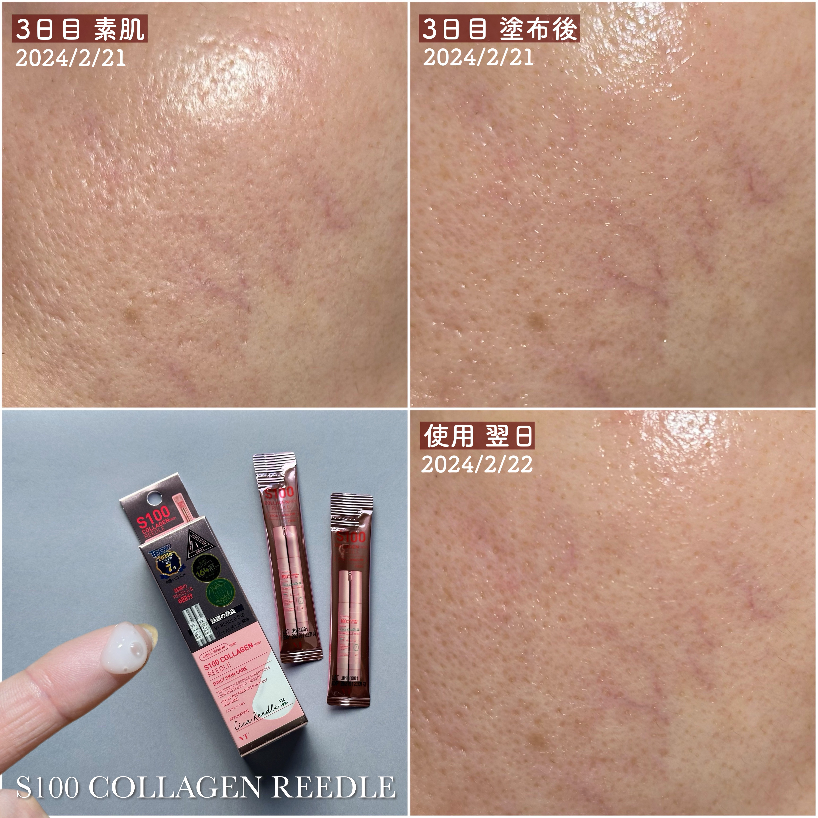 リードルS 100 2ステップマスク/VT/シートマスク・パックを使ったクチコミ（3枚目）