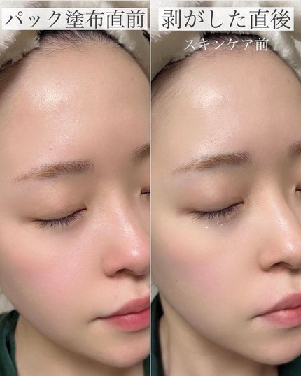 プレミアムローサモデリングマスク/Dr.Althea/マスクを使ったクチコミ(5枚目)