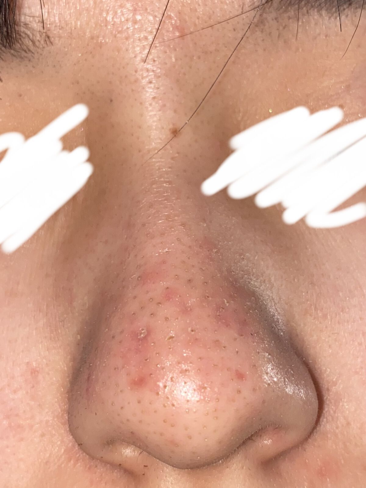 CICA クリーム/VT/フェイスクリームを使ったクチコミ（2枚目）