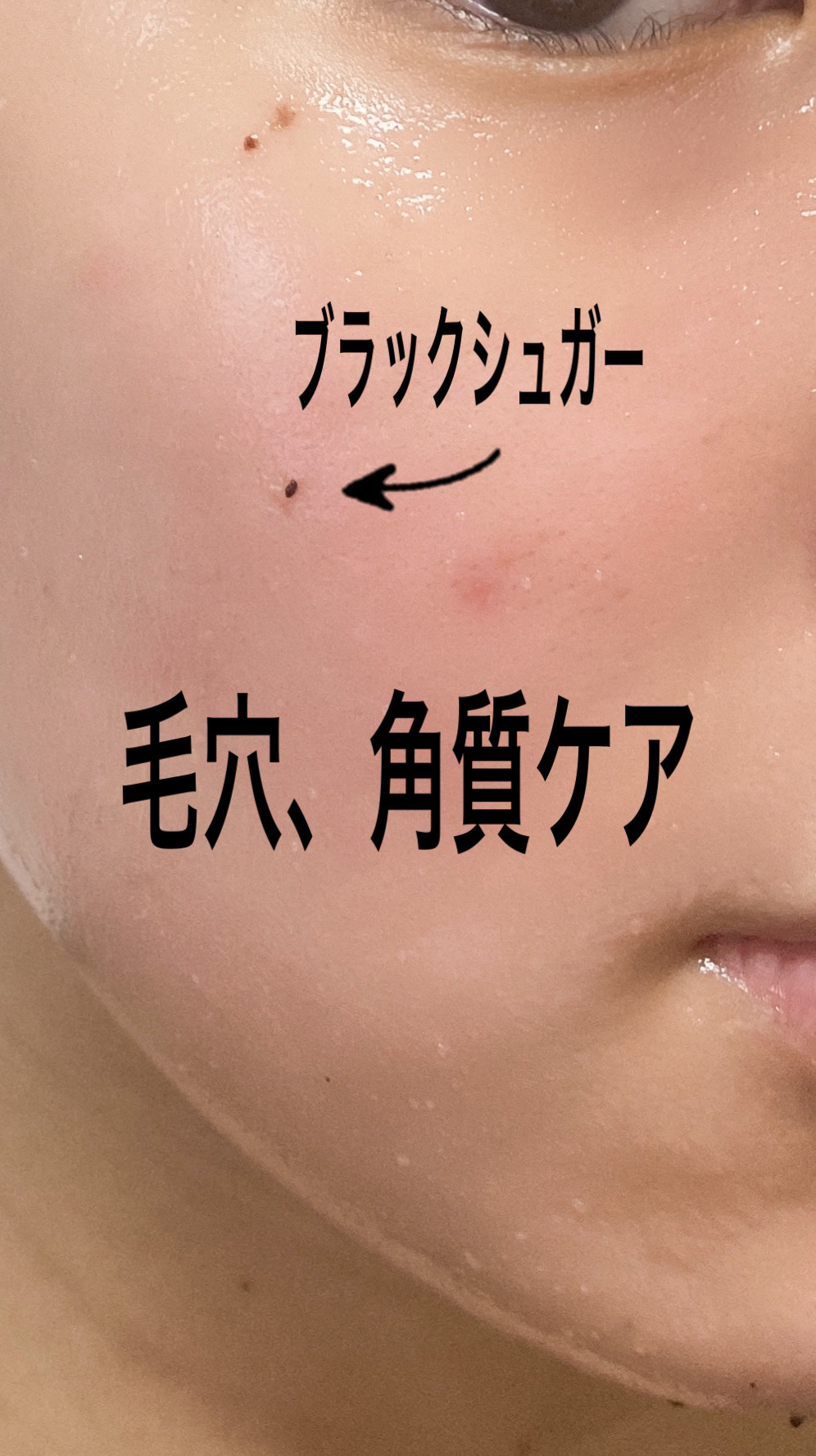 ストロベリーシュガー フードマスク/SKINFOOD/洗い流すパック・マスクを使ったクチコミ（3枚目）