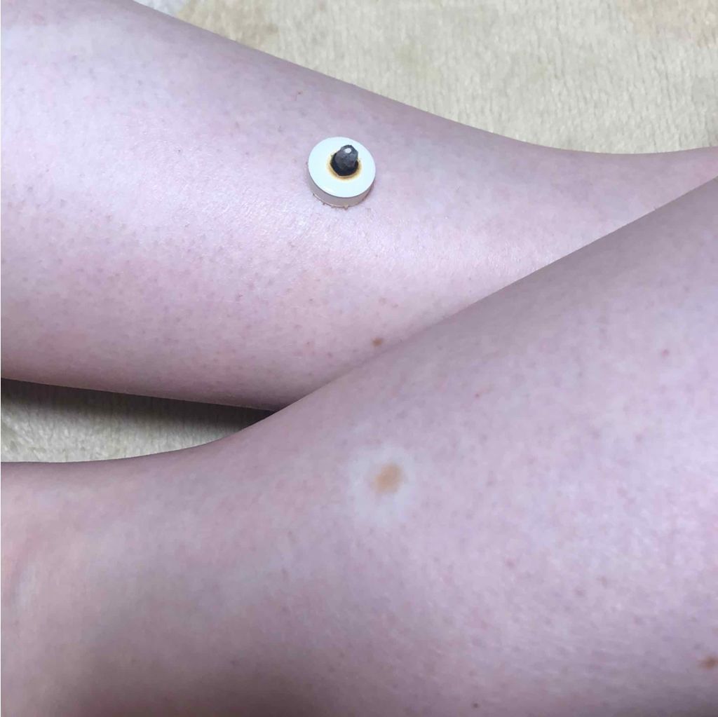 はじめてのお灸moxa Encens 香木のかほり/せんねん灸/その他を使ったクチコミ（2枚目）