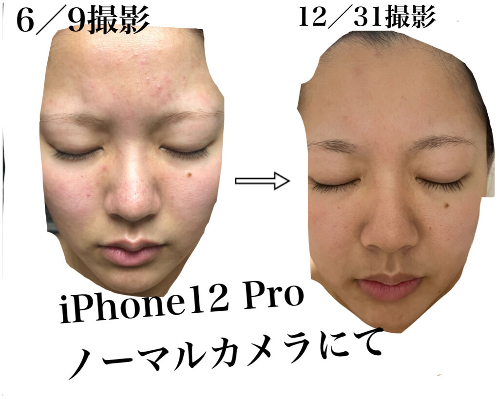 クリーム UFC/Kiehl's/フェイスクリームを使ったクチコミ（1枚目）