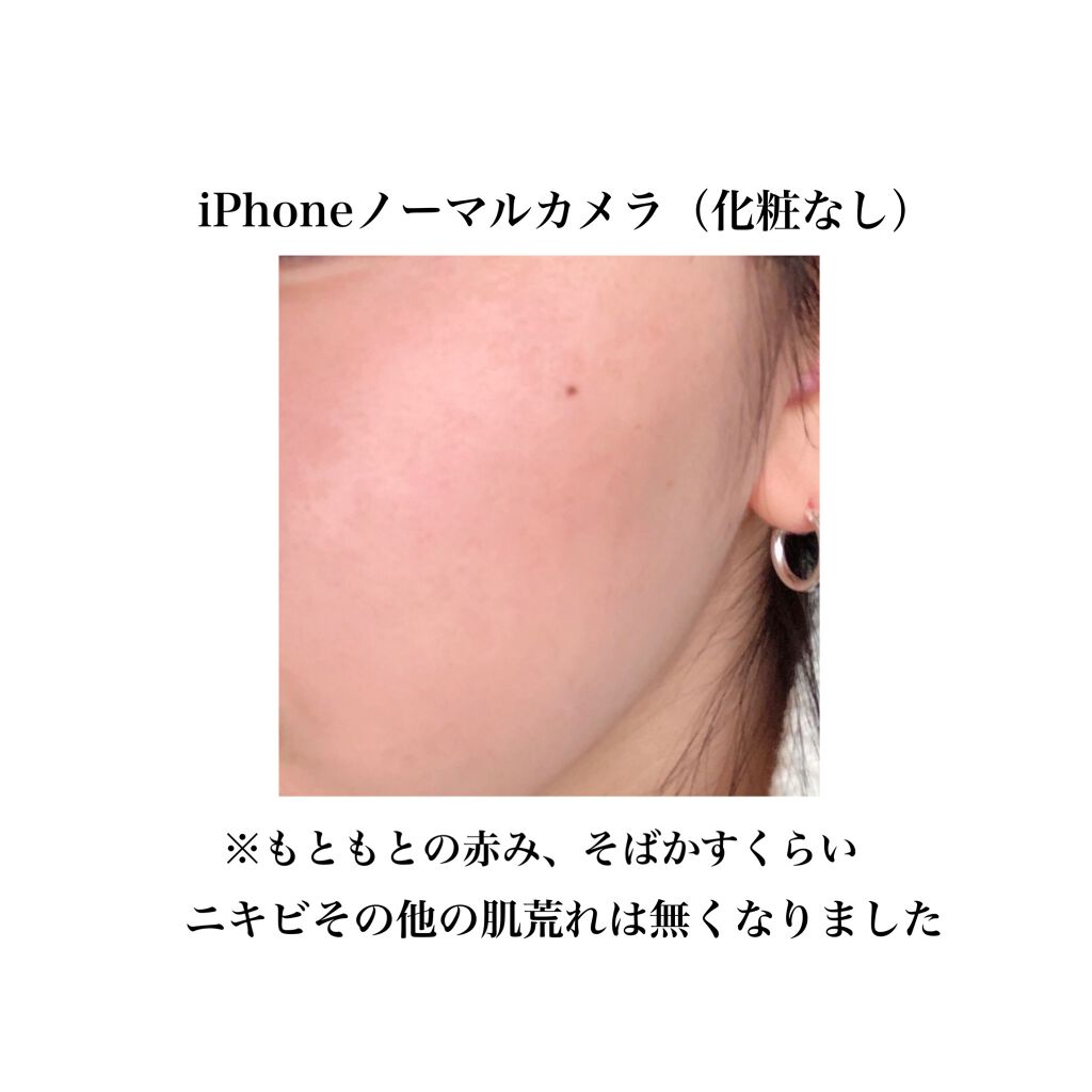 イハダ 薬用バーム【医薬部外品】/IHADA/フェイスバームを使ったクチコミ(1枚目)