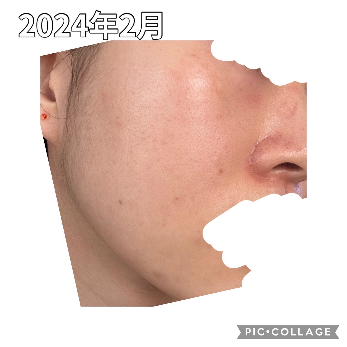 ハトムギ浸透乳液(ナチュリエ スキンコンディショニングミルク)/ナチュリエ/乳液を使ったクチコミ(6枚目)