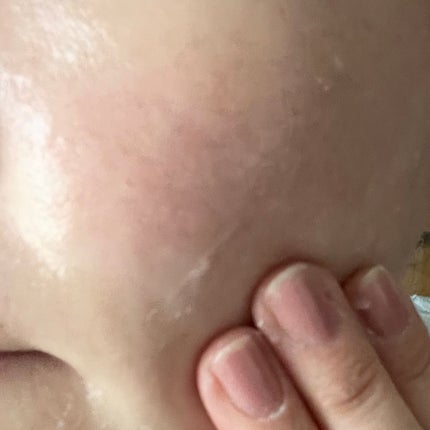 メルティング バーム W クレンズ/アンテリージェEX/クレンジングバームを使ったクチコミ(7枚目)