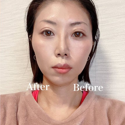 ピンクティーツリーカバークッション/APLIN/クッションファンデーションを使ったクチコミ(7枚目)