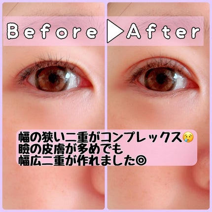 TWOOLダブルアイリッドハイブリットフィルム/SHOBIDO/二重まぶた用アイテムを使ったクチコミ(2枚目)