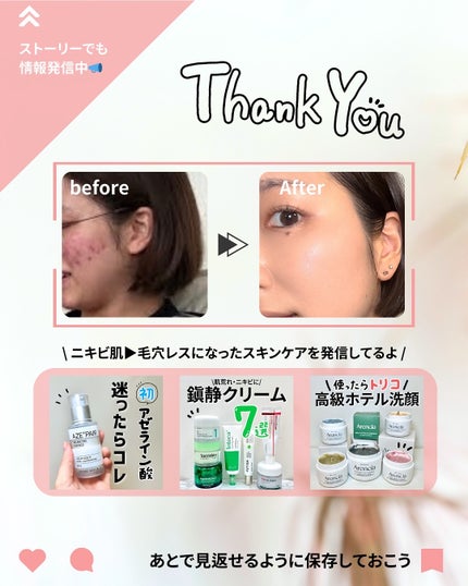 ブースターソニック/Glow.M/美顔器・マッサージを使ったクチコミ(8枚目)