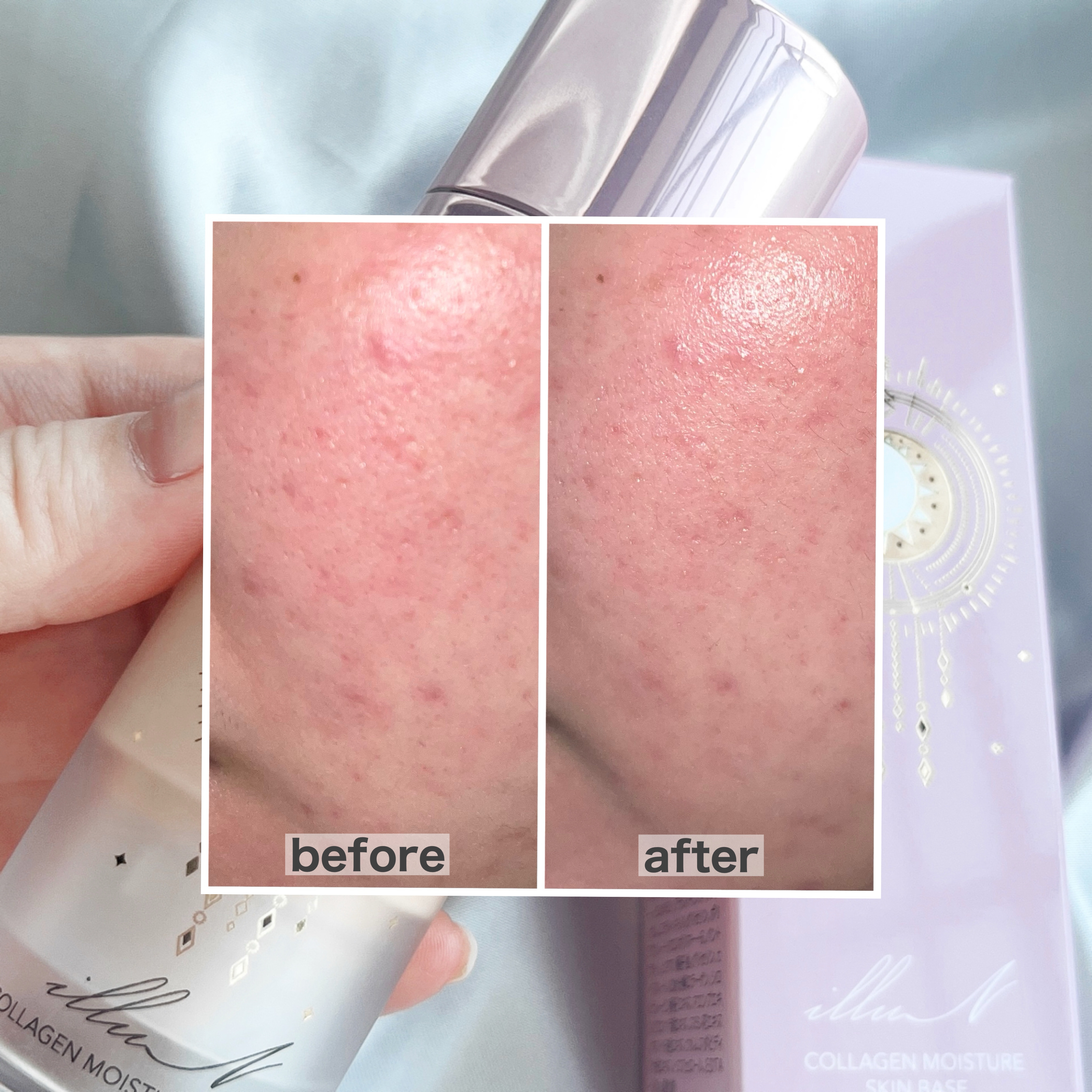 コラーゲンモイスチャースキンベース/illuN/化粧下地を使ったクチコミ（3枚目）