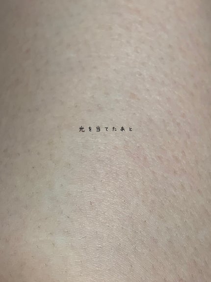 光脱毛器 VIO/Sarlisi/家庭用脱毛器を使ったクチコミ(6枚目)